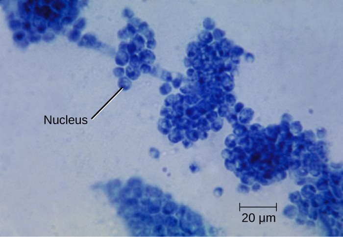 Candida albicans is a unicellular fungus, or yeast. It is the causative agent of vaginal yeast infections as well as oral thrush, a yeast infection of the mouth that commonly afflicts infants. C. albicans has a morphology similar to that of coccus bacteria; however, yeast is a eukaryotic organism (note the nuclei) and is much larger.