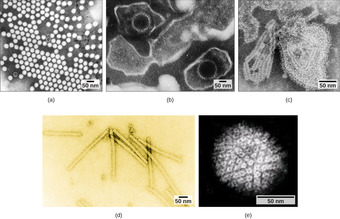 Transmission electron micrograph of viruses