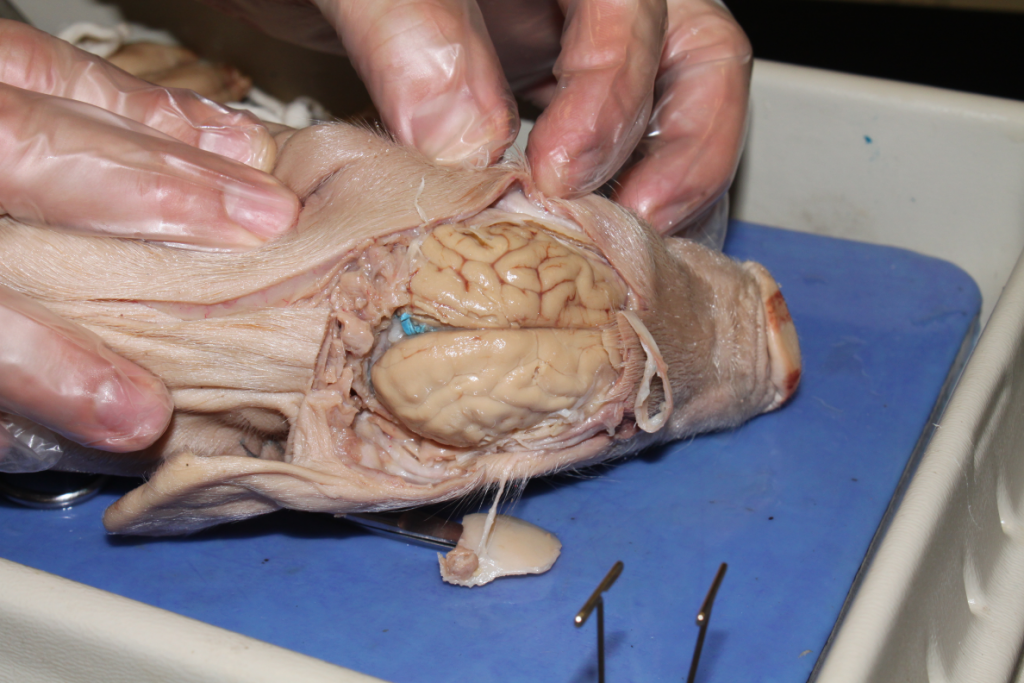 Surface of the cerebral cortex.