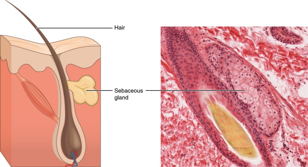 Diagram and image of sebaceous glands