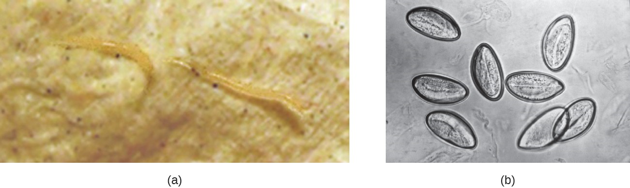(a) E. vermicularis are tiny nematodes commonly called pinworms. (b) This micrograph shows pinworm eggs.