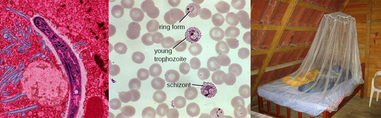 Malaria is a disease caused by a eukaryotic parasite transmitted to humans by mosquitos. Micrographs (left and center) show a sporozoite life stage, trophozoites, and a schizont in a blood smear. On the right is depicted a primary defense against mosquito-borne illnesses like malaria—mosquito netting.