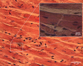 Cardiomyocytes