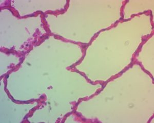 Image of lung alveoli showing the squamous epithelium