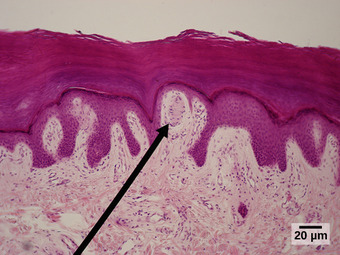Meissner corpuscles