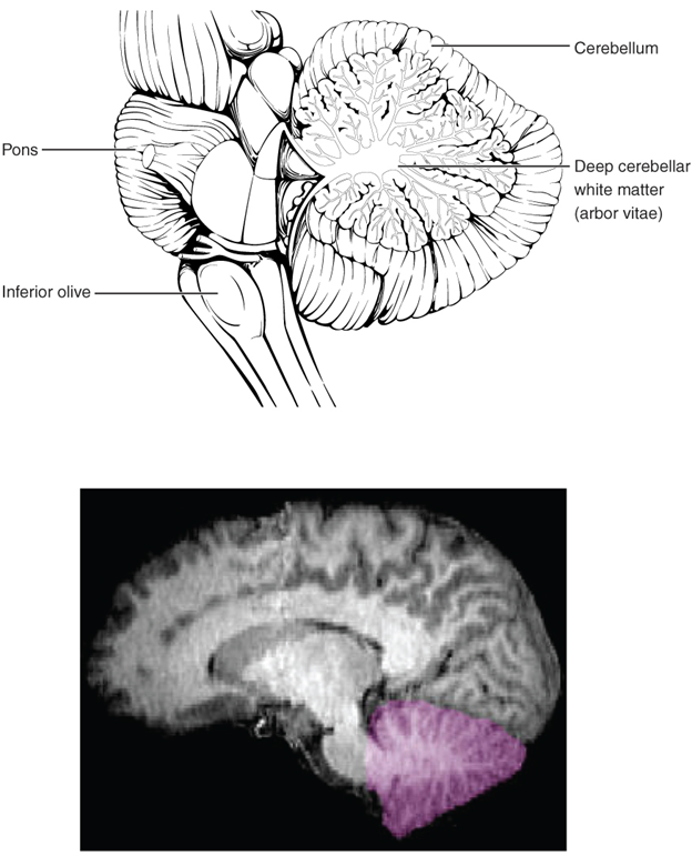Diagram and x-ray photo of cerabellum