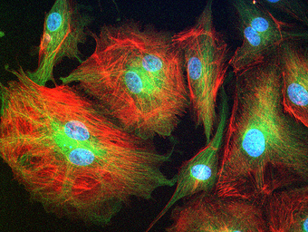 Tubulin