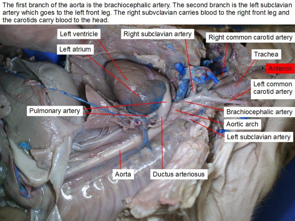 Aorta, aortic arch, left atrium, brachiocephalic artery, left common carotid artery, right common carotid artery, ductus arteriosus, pulmonary artery, pulmonary trunk, left subclavian artery, right subclavian artery, trachea, left ventricle.
