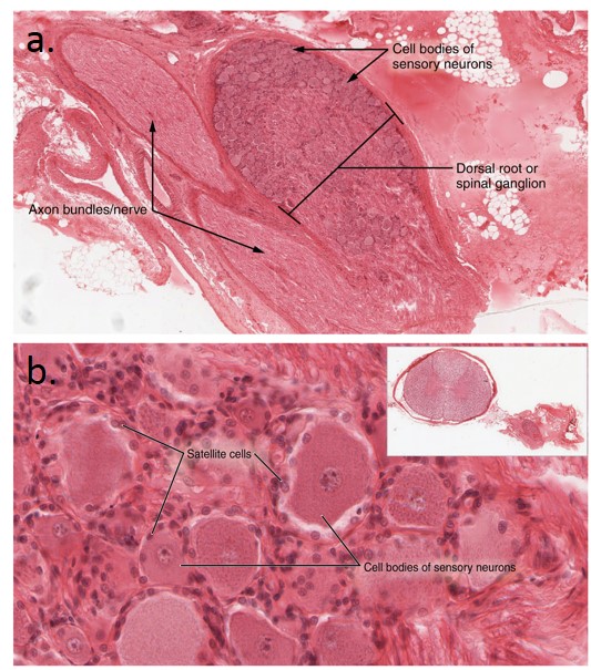 The top micrograph shows the structure of the dorsal root ganglion. The cell bodies of the neurons and the axon bundles are also labeled. The bottom micrograph shows a magnified view of the dorsal root ganglion, showing the satellite cells and the cell bodies of sensory neurons.