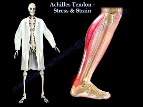 Thumbnail for the embedded element "Achilles Tendon Stress & Strain - Everything You Need To Know - Dr. Nabil Ebraheim"