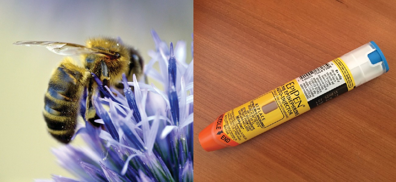 Bee stings and other allergens can cause life-threatening, systemic allergic reactions. Sensitive individuals may need to carry an epinephrine auto-injector (e.g., EpiPen) in case of a sting. A bee-sting allergy is an example of an immune response that is harmful to the host rather than protective; epinephrine counteracts the severe drop in blood pressure that can result from the immune response.