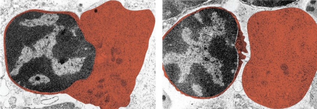 Red blood cell extruding its nucleus.