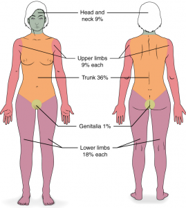 Diagram of human body split into percentages to calculate size of burns