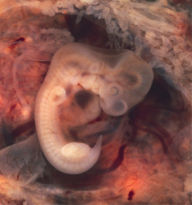 Embryo at seven weeks