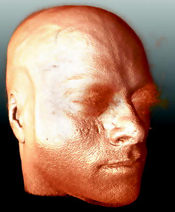 A271722_1_En_22_Fig2_HTML.jpg