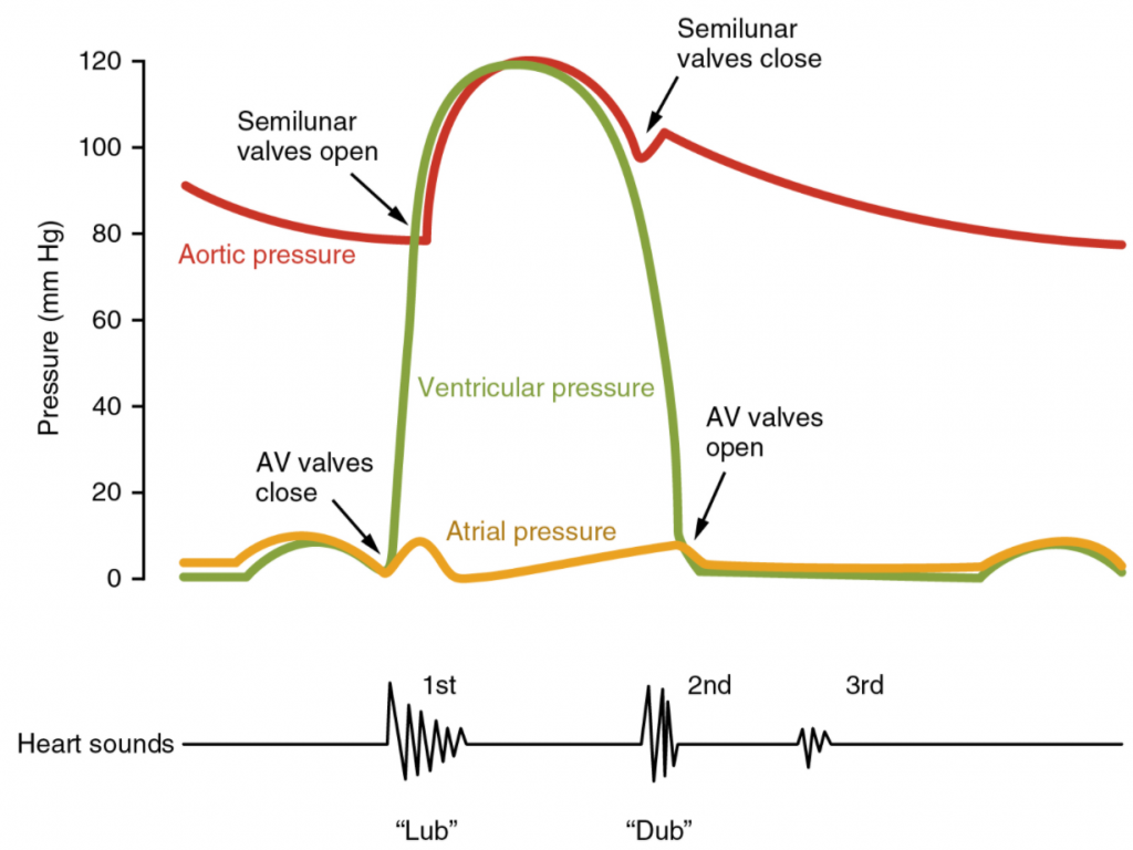 Graph of heart sounds