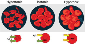 Response of red blood cells in hypertonic, hypotonic, and isotonic solutions