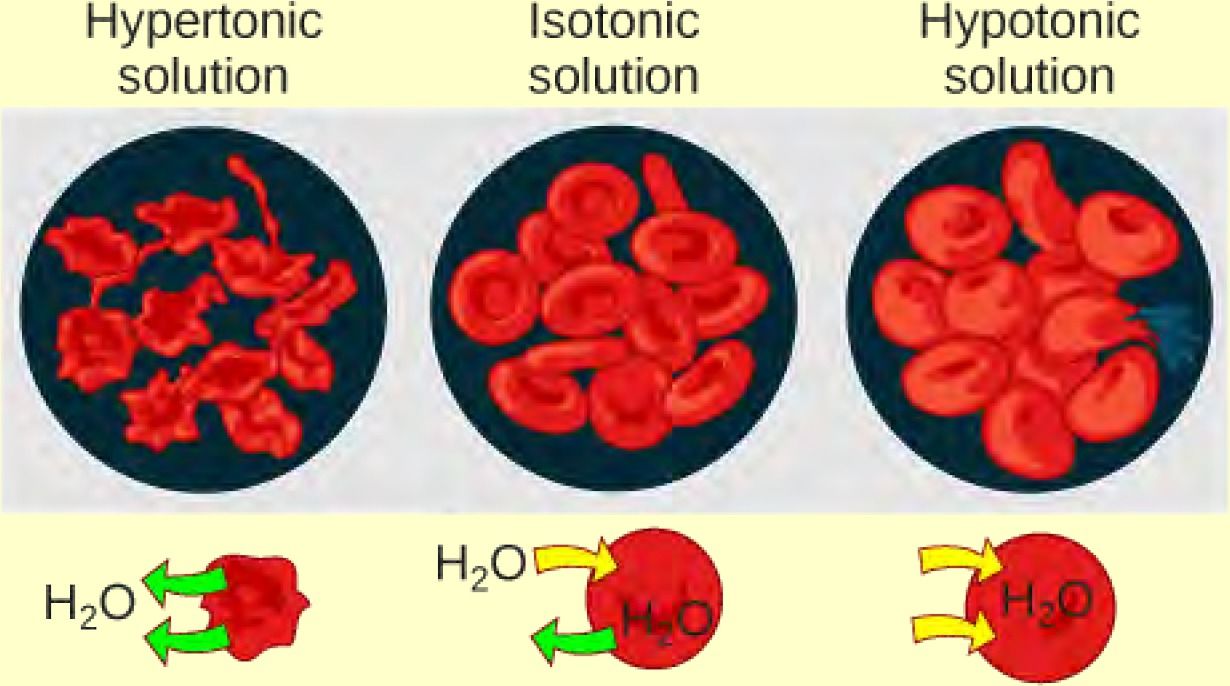 Illustration of red blood cells in hypotonic, isotonic, and hypertonic solutions. In the hypertonic solution, the cells shrivel and take on a spiky appearance. In the isotonic solution, the cells are normal in appearance. In the hypotonic solution, the cells swell and one has ruptured.