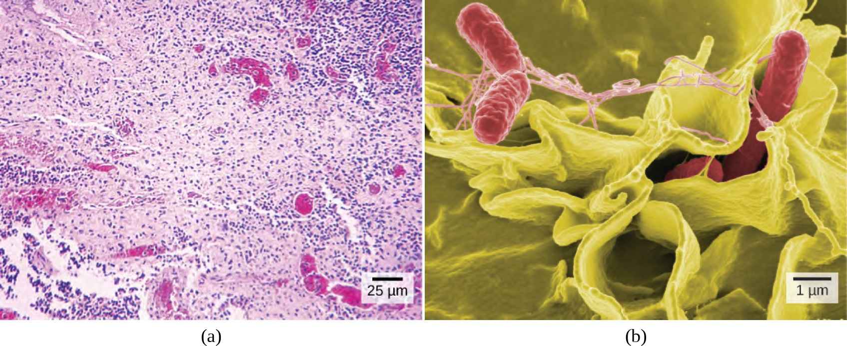 Part a: Salmonella viewed through a light microscope appear as tiny purple dots. Part b: In this scanning electron micrograph, the bacteria appear as three-dimensional red ovals. The human cells are much larger with a complex, folded appearance. Some of the bacteria lie on the surfaces of the human cells, and some are squeezed between them.
