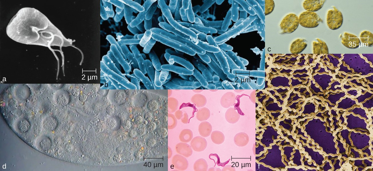 Microorganisms vary visually in their size and shape, as can be observed microscopically; but they also vary in invisible ways, such as in their metabolic capabilities.