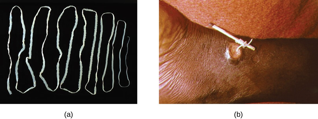 (a) The beef tapeworm, Taenia saginata, infects both cattle and humans. T. saginata eggs are microscopic (around 50 µm), but adult worms like the one shown here can reach 4–10 m, taking up residence in the digestive system. (b) An adult guinea worm, Dracunculus medinensis, is removed through a lesion in the patient’s skin by winding it around a matchstick.