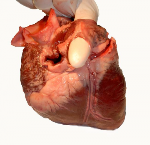 The two entrances of the vena cavae.