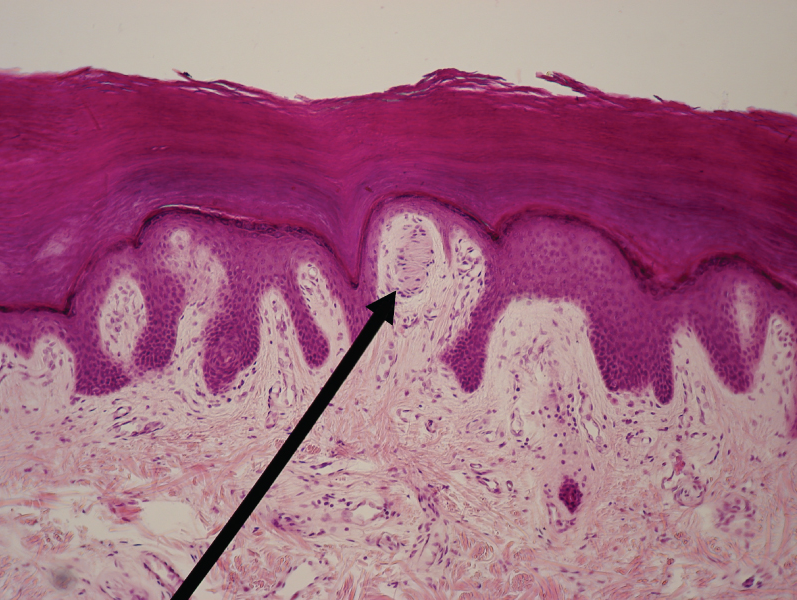Light micrograph of a Meissner corpuscle