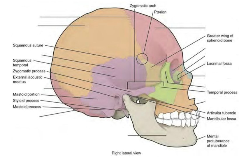 The lateral skull shows the large rounded brain case, zygomatic arch, and the upper and lower jaws. The zygomatic arch is formed jointly by the zygomatic process of the temporal bone and the temporal process of the zygomatic bone. The shallow space above the zygomatic arch is the temporal fossa. The space inferior to the zygomatic arch and deep to the posterior mandible is the infratemporal fossa.
