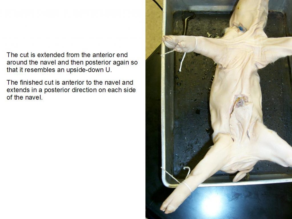 Figure 13.7. Cut in shape of U on abdomen.