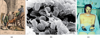 Bubonic plague
