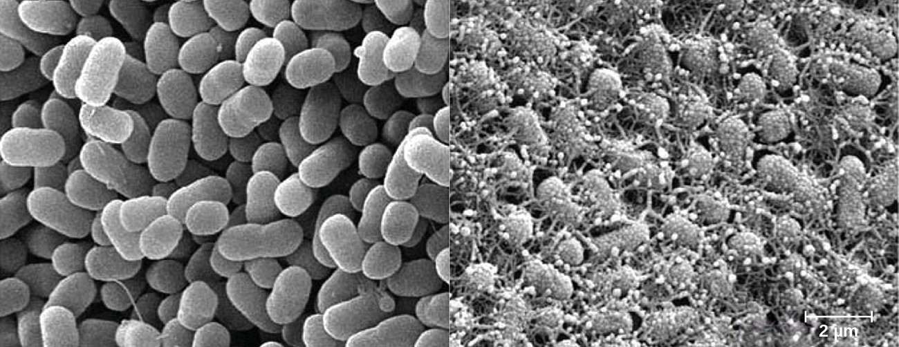 E. coli O157:H7 causes serious foodborne illness. Curli fibers (adhesive surface fibers that are part of the extracellular matrix) help these bacteria adhere to surfaces and form biofilms. Pictured are two groups of cells, curli non-producing cells (left) and curli producing cells (right).