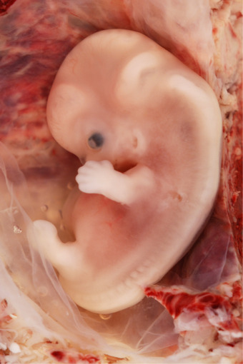 First trimester
