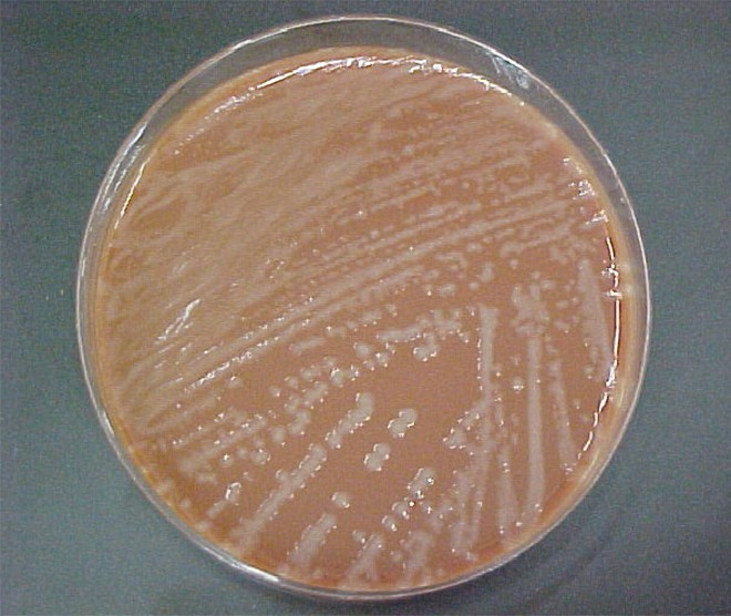 Culture of Haemophilus influenzae on a chocolate agar plate.