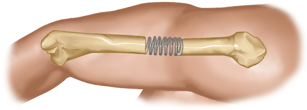 A human arm from the shoulder to below the elbow is drawn with the upper arm bone (humerus) superimposed in anatomical position. The central section of the bone is actually drawn as a spring, which blends gradually back into bone on either end of the section.