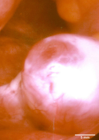 Follicle