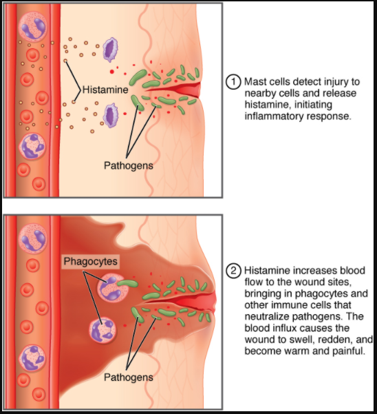 Daiagram of an inlammatory response