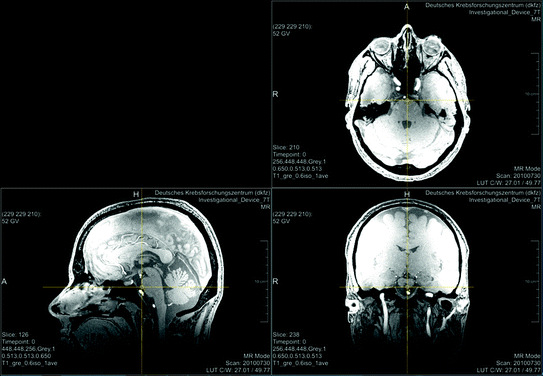 A271722_1_En_22_Fig1_HTML.gif