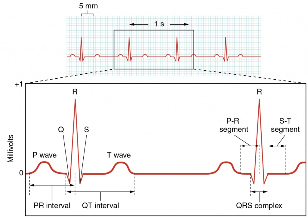 Electrocardiogram