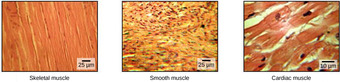 Types of muscle
