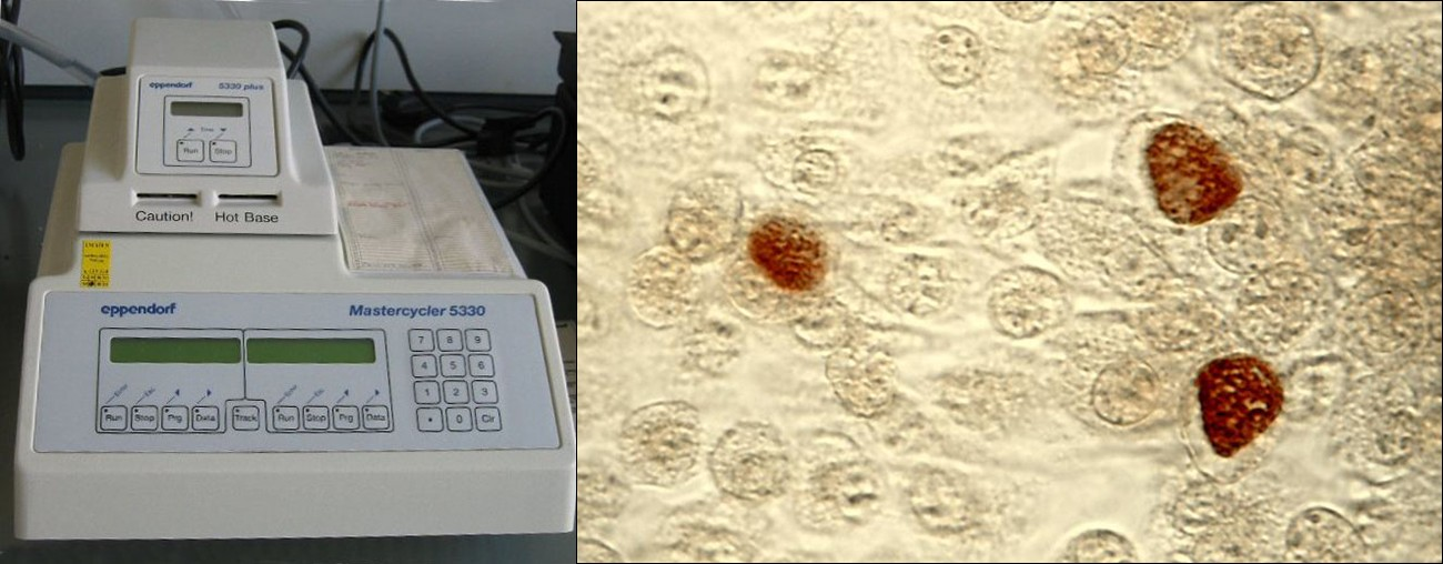 A thermal cycler (left) is used during a polymerase chain reaction (PCR). PCR amplifies the number of copies of DNA and can assist in diagnosis of infections caused by microbes that are difficult to culture, such as Chlamydia trachomatis (right). C. trachomatis causes chlamydia, the most common sexually transmitted disease in the United States, and trachoma, the world’s leading cause of preventable blindness.