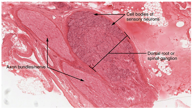 Dorsal root ganglion.