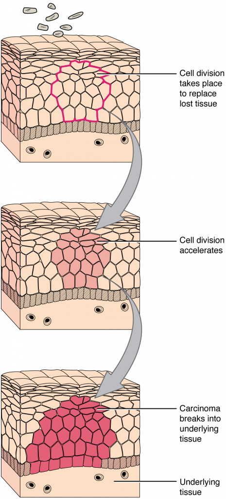 Diagram on the deelopment of cancer in the body