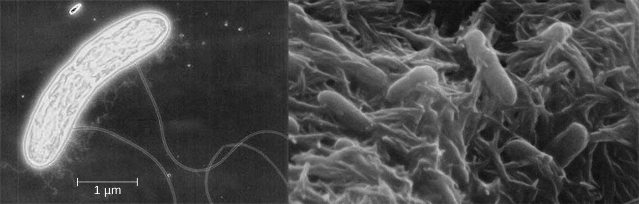 The bacterium Shewanella lives in the deep sea, where there is little oxygen diffused in the water. It is able to survive in this harsh environment by attaching to the sea floor and using long appendages, called “nanocables,” to sense oxygen.