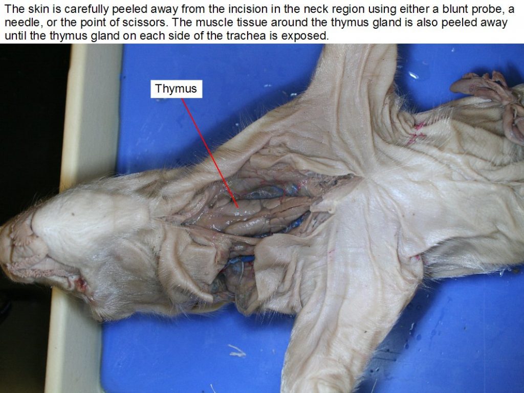 Ventral view of open neck. Thymus.