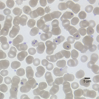 Plasmodium