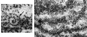 Several swirls and some loops composed of small dot-like structures; each one is a little different in shape and size (e.g., some are more oval than others).