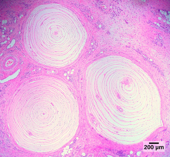 Pacinian corpuscles