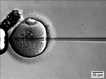 Intracytoplasmic sperm injection