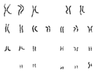 A human karyotype