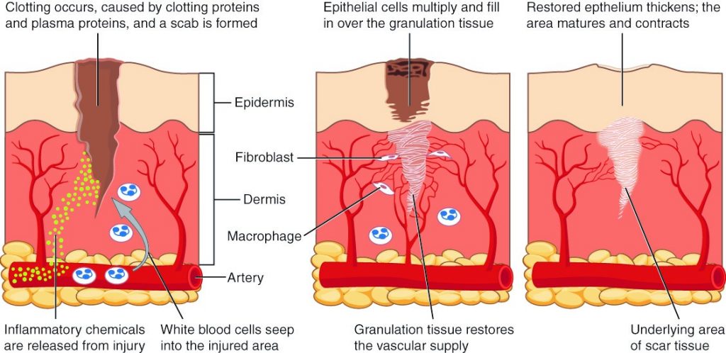 Diagram of healing tissue